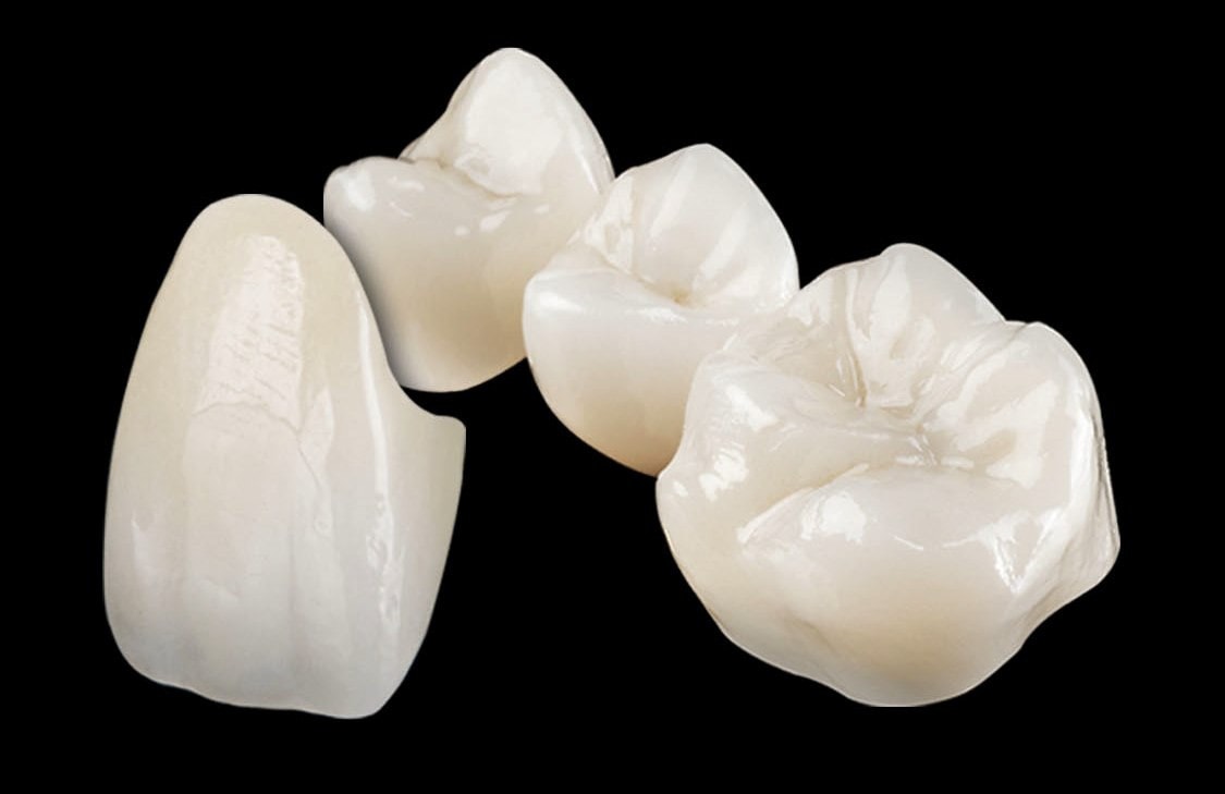 All ceramic crowns